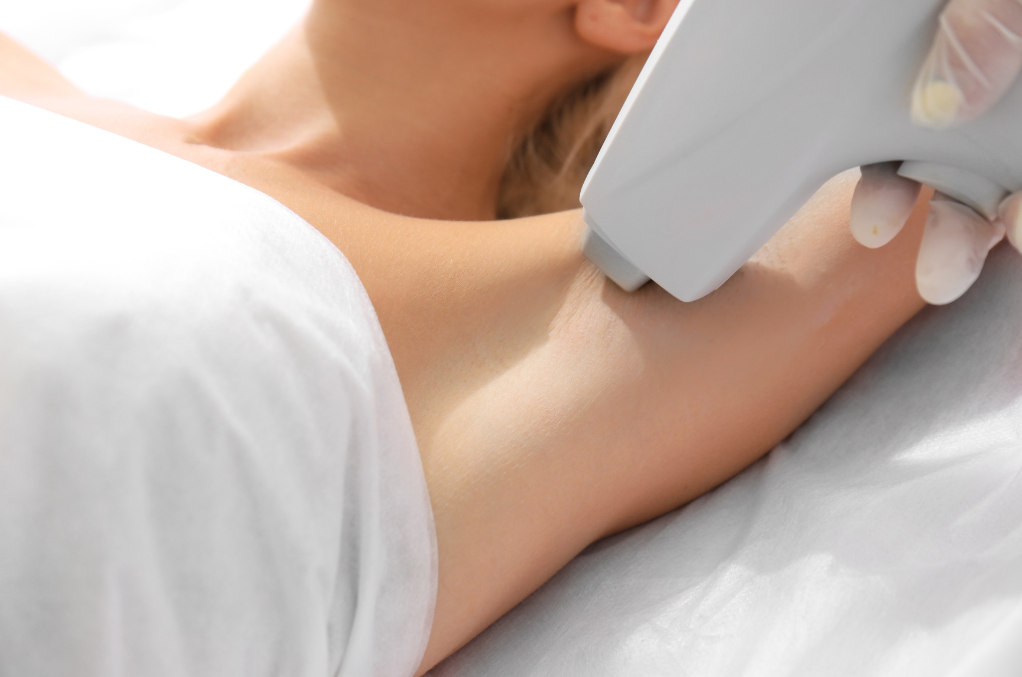 Laser Hair Removal In Memphis